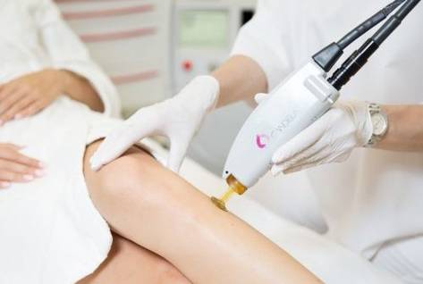 Лазерная эпиляция: главные опасности и как их избежать - блог центра лазерной эпиляции в Киеве, Laser Health