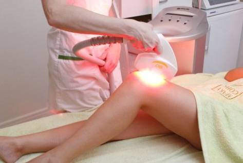 Инновационные методы эпиляции - блог центра лазерной эпиляции в Киеве, Laser Health
