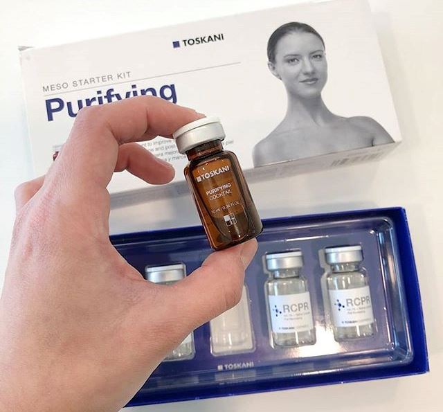 Мезотерапия